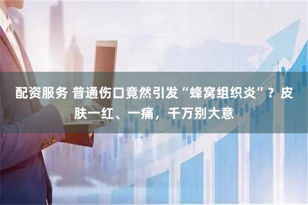 配资服务 普通伤口竟然引发“蜂窝组织炎”？皮肤一红、一痛，千万别大意